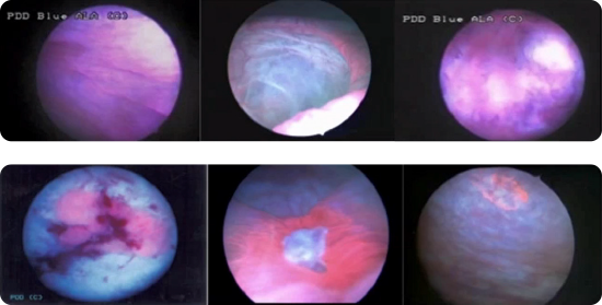 resection management 3